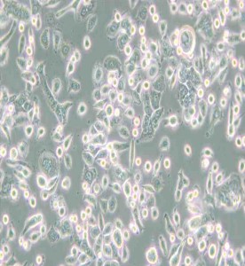 AsPC-1人轉(zhuǎn)移胰腺腺癌細(xì)胞主圖