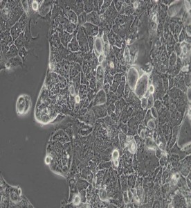 Caco-2人結(jié)直腸腺癌細胞主圖