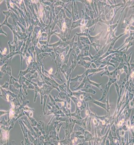 Super/Tube犬腎細胞主圖