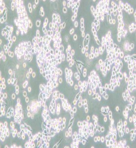 B95-8絨猴EB病毒轉(zhuǎn)化的白細(xì)胞主圖