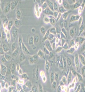 SUM149PT人乳腺癌細胞主圖