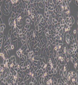 MDA-MB-468人乳腺癌細胞(L15)主圖